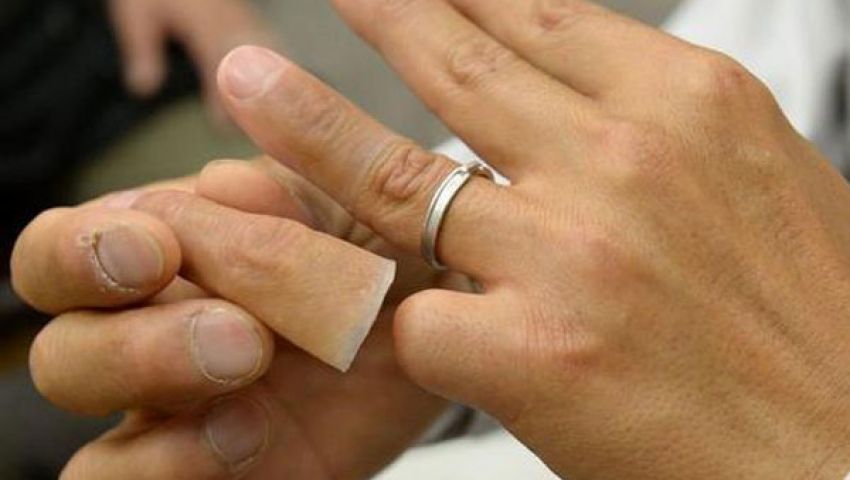 اليابان.. غسيل تاريخ المافيا بأصابع صناعية
