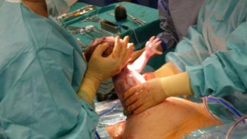 الولادة القيصرية فى مصر.. بيزنس أم ضرورة صحية؟
