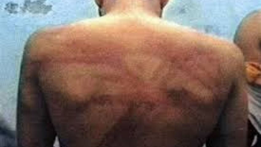 بلاغ: 1000 حالة تعذيب للإسلاميين بمعسكرات المركزي 