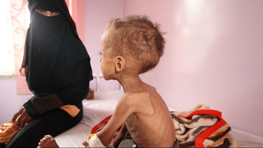 يونيسف: وباء الكوليرا يتفشى بشكل مخيف في اليمن
