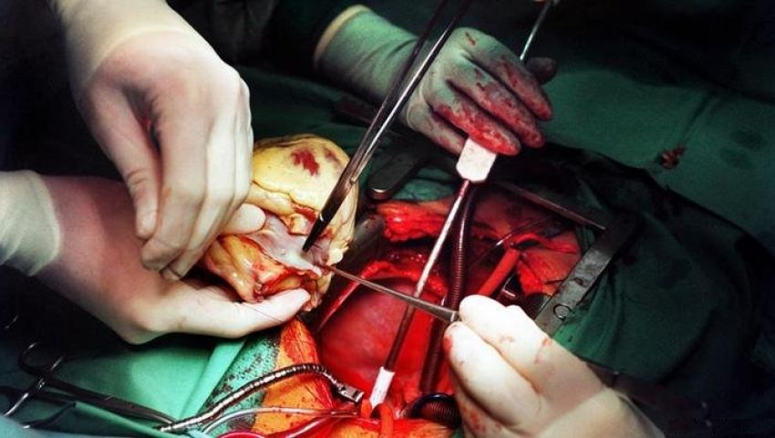  القلب الميت.. إنجاز طبي يقلب موازين زرعة الأعضاء