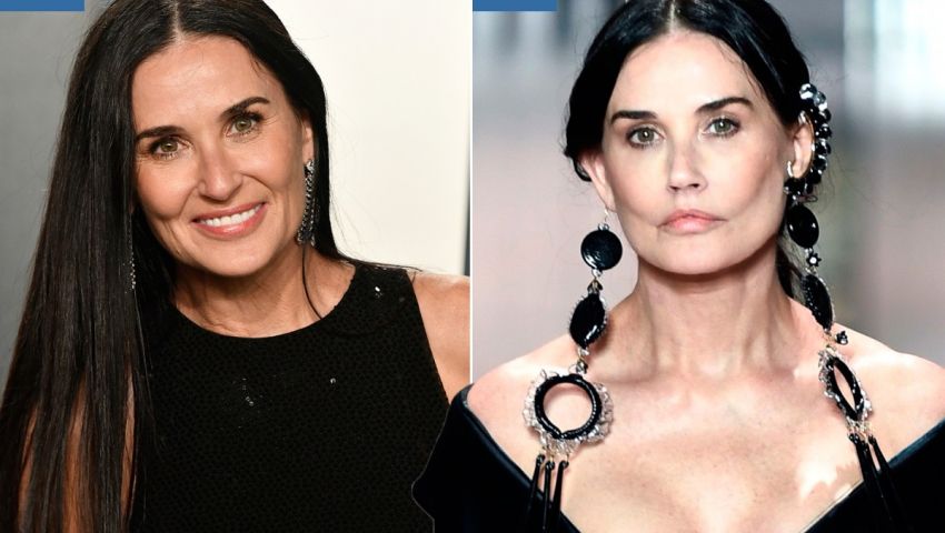 فيديو| آخرها تشوه وجه «ديمي مور».. نجمات دفعن ضريبة عمليات التجميل