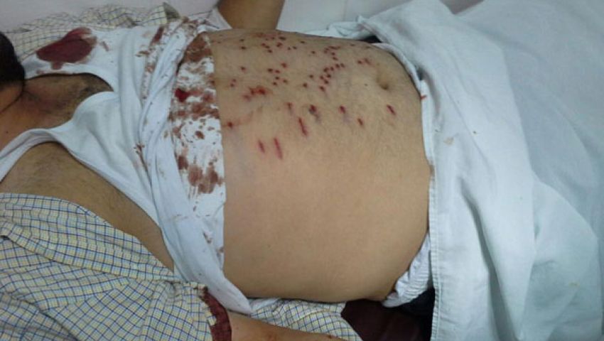 بلاغ يطالب بترحيل سوريين لارتكابهم عنف ضد معارضي مرسي