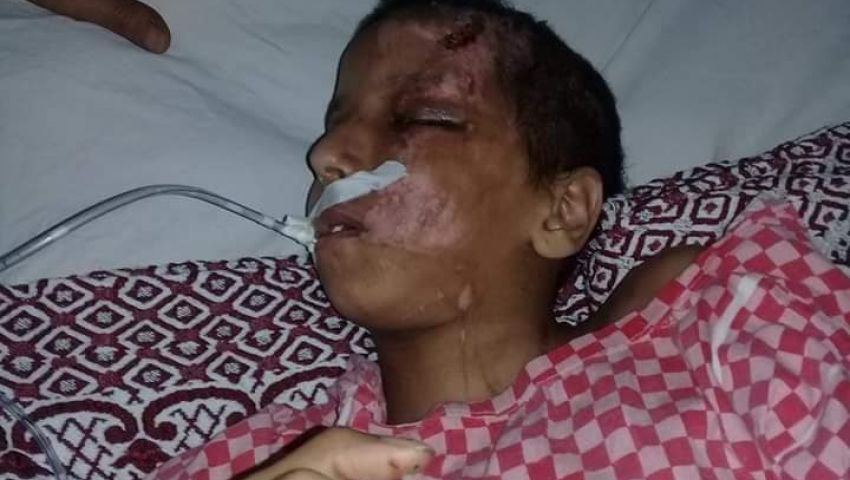 بالصور: المصعد يسرق فرحة «فرح».. والأب يستغيث