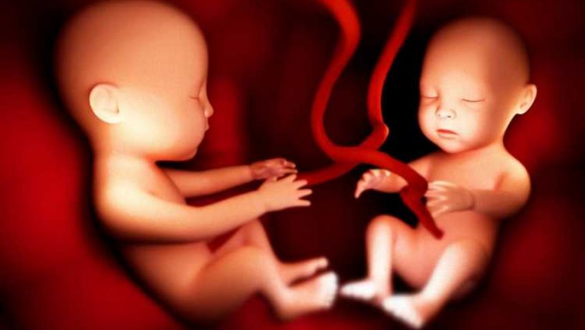 فيديو| اختفاء توأم من رحم سيدة حامل بالأقصر.. ما القصة؟